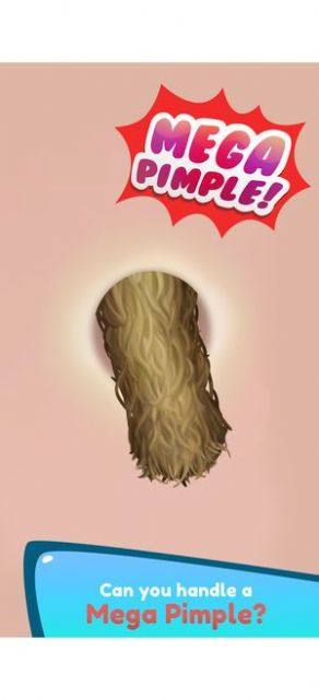 挤痘痘模拟小游戏中文安卓版图片2