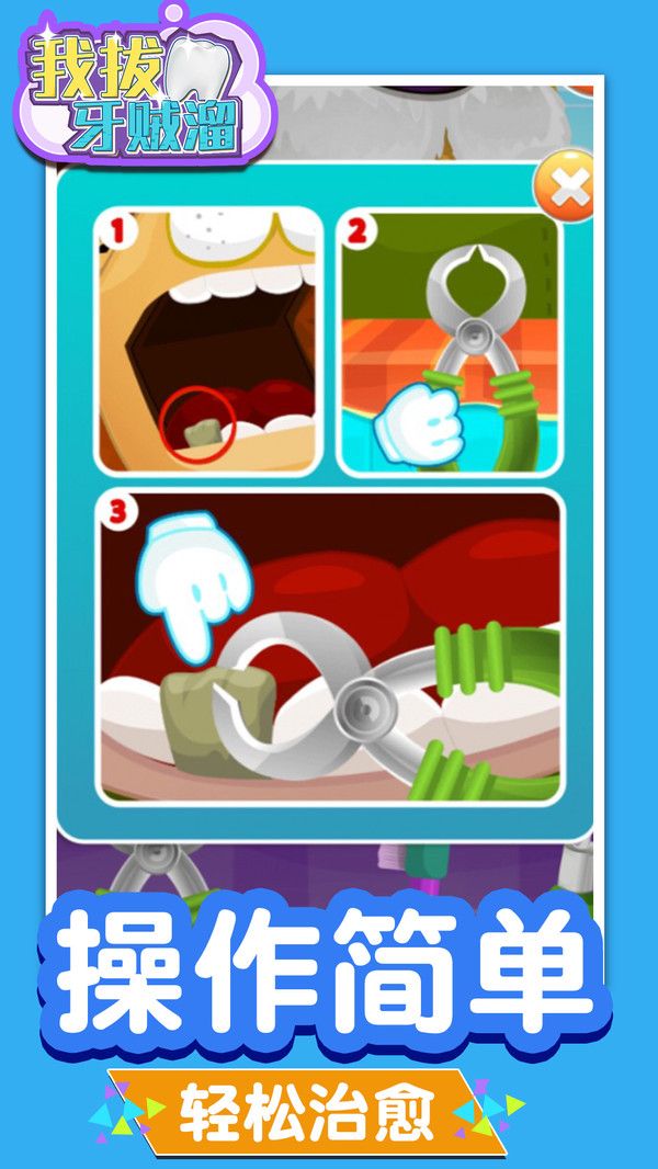 我拔牙贼溜游戏图1