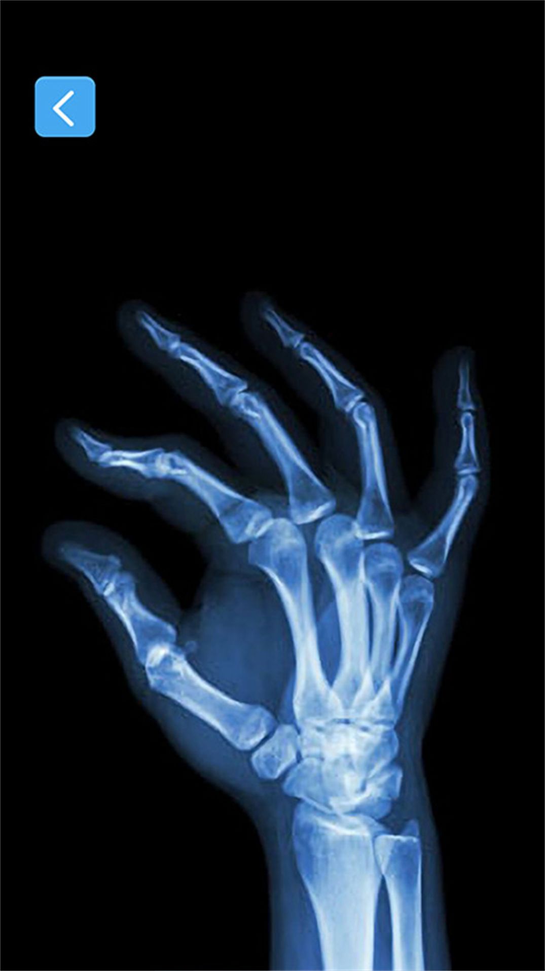 X射线模拟器游戏安卓官方版图片1