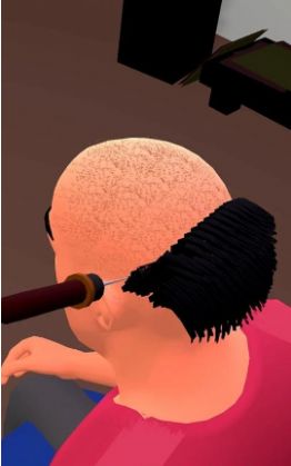 3D植发小游戏图1