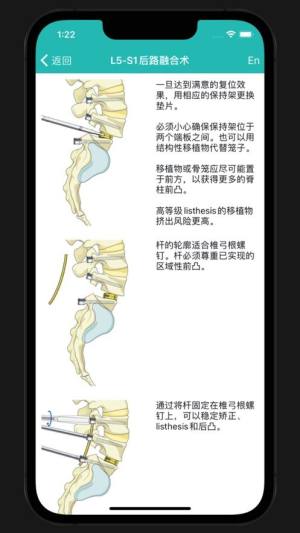 脊柱创伤app图1