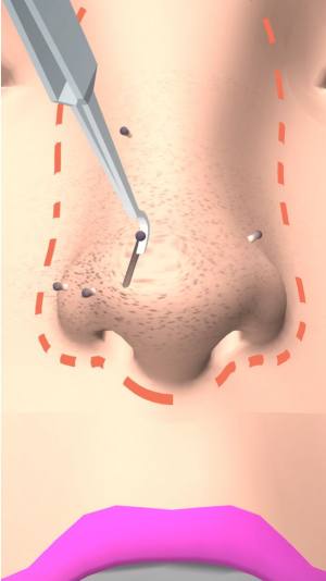 干净的鼻子游戏官方最新版图片1