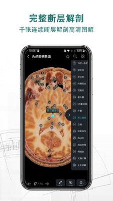 掌上3D解剖app图3