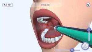 牙医模拟手机版图1