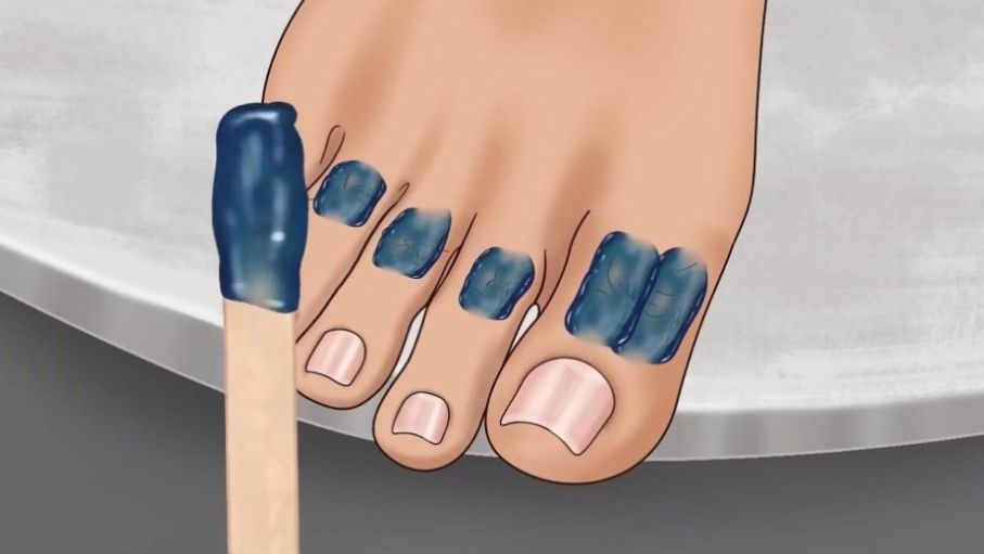 修脚足疔模拟器游戏图2