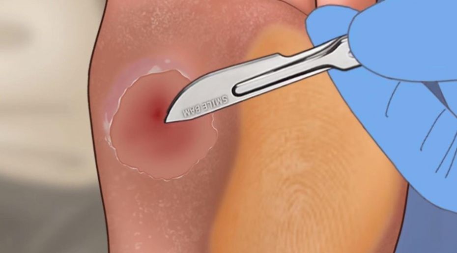 修脚足疔模拟器游戏官方版图片1