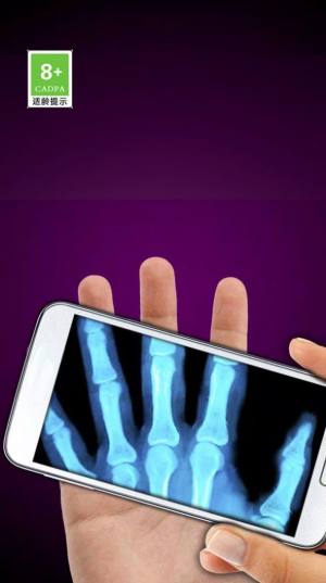 模拟X射线游戏最新安卓版图片1